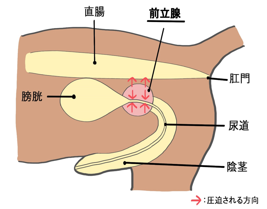 前立腺腫瘍 ペット保険のfpc