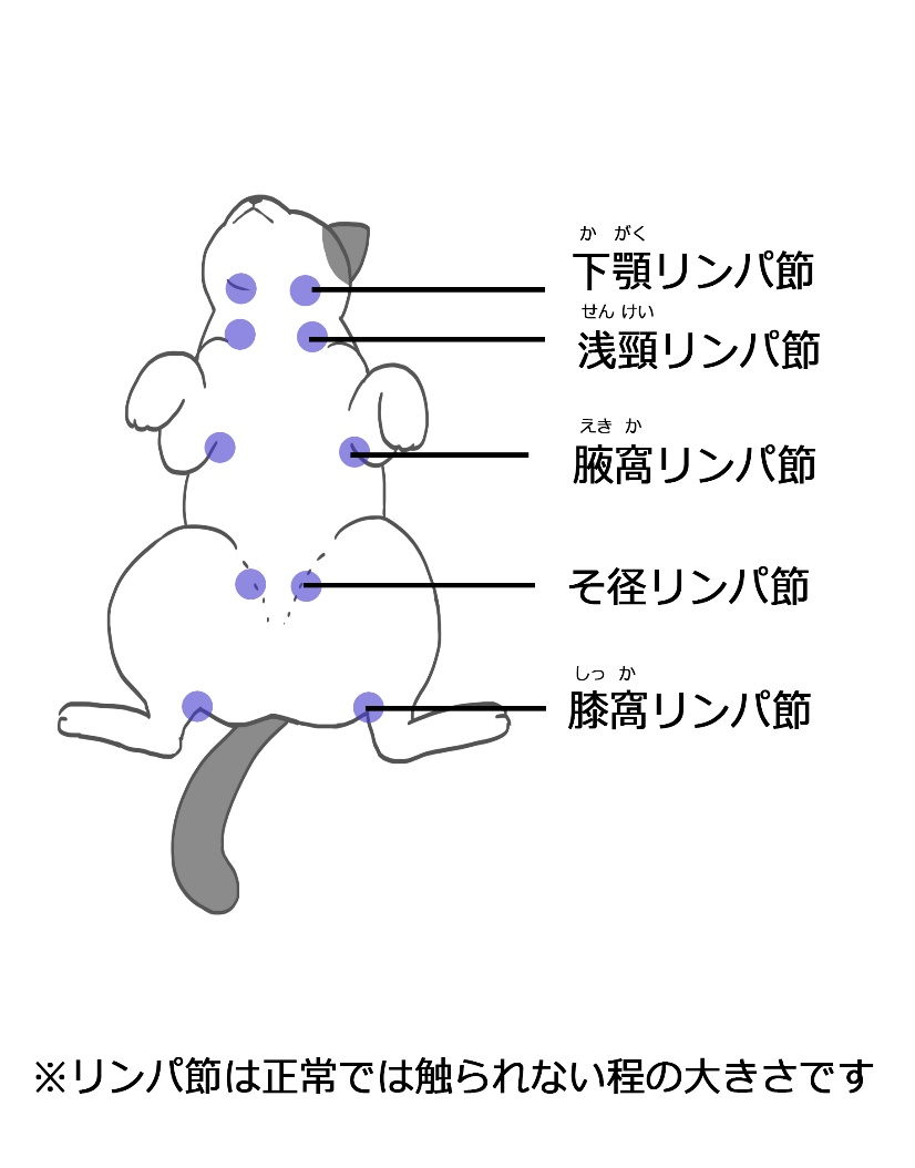 体表リンパ節の模式図