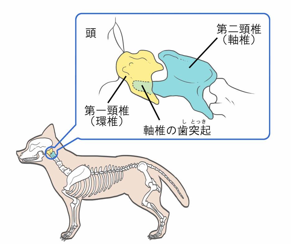 環軸椎不安定症の模式図