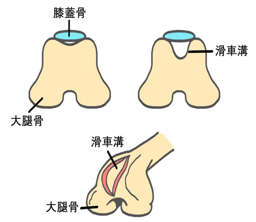 脱臼2